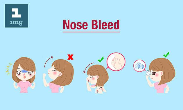 what-causes-a-nose-bleed-out-of-the-blue-deals-www-cooksrecipes