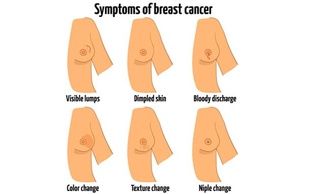 6 possible reasons for breast pain