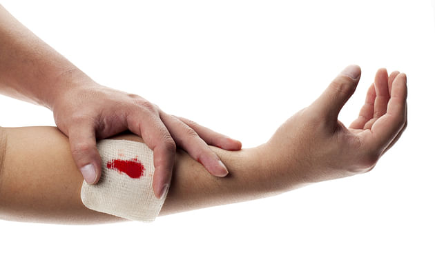 How to heal cuts and minor wounds | Bepanthen Australia