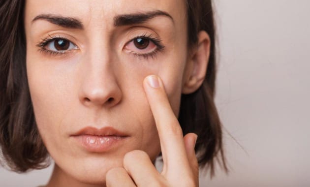 Eye Flu Spike: Home Care & Essential Tips To Stay Safe – Tata 1mg Capsules